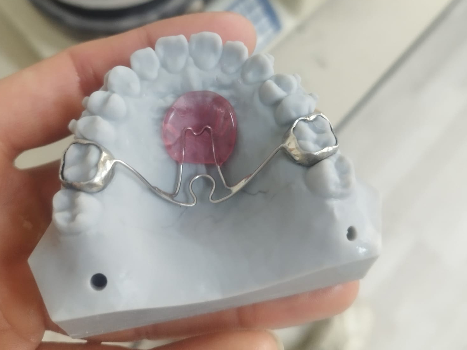 orthodontie